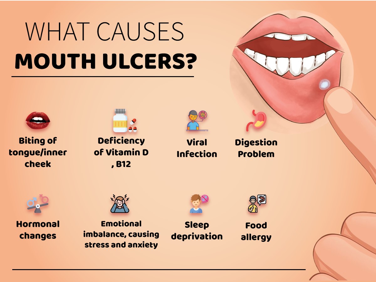 Yoga/Pranayama for mouth ulcers