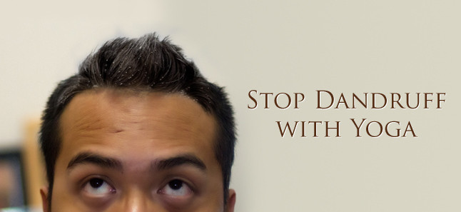 Yoga for Dandruff | The Art of Living | The Art Of Living India Yoga for Dandruff | The Art of Living | The Art Of Living India